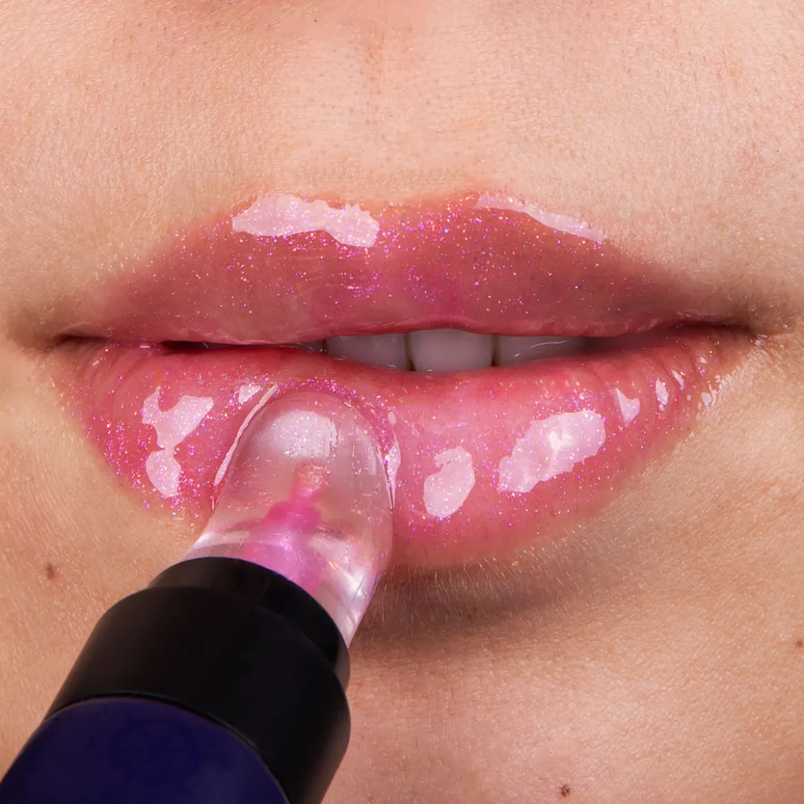 SpongeBob - Patrick Star Lipgloss